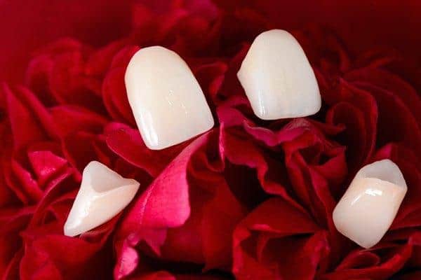 dental-veneers-detail